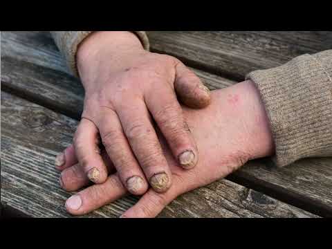 Dirty hands in need of cleaning, ideal for M.A.T.E. Industrial Hand Cleaner - Paradise Nutrients